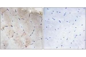 Immunohistochemistry analysis of paraffin-embedded human skeletal muscle tissue, using Collagen XII alpha1 Antibody. (COL12A1 抗体  (AA 1481-1530))