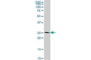 IDI1 monoclonal antibody (M01), clone 6G10 Western Blot analysis of IDI1 expression in HeLa . (IDI1 抗体  (AA 175-283))