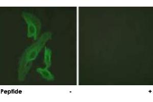Immunofluorescence analysis of HeLa cells, using BCL2L1 polyclonal antibody . (BCL2L1 抗体)