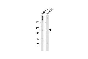 All lanes : Anti-Mouse Lats2 Antibody (C-term) at 1:2000 dilution Lane 1: Mouse ovary tissue lysate Lane 2: Mouse testis tissue lysate Lysates/proteins at 20 μg per lane. (LATS2 抗体  (C-Term))