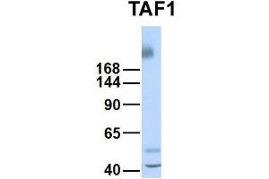 Host:  Rabbit  Target Name:  TAF1  Sample Type:  Human Fetal Liver  Antibody Dilution:  1. (TAF1 抗体  (Middle Region))