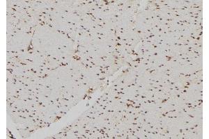 ABIN6260816 and ABIN6269226 at 1/100 staining Human gastric tissue by IHC-P.