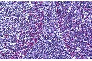 Human Tonsil: Formalin-Fixed, Paraffin-Embedded (FFPE) (FANCA 抗体  (AA 1121-1170))