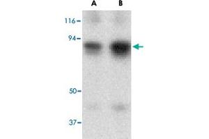 Western blot analysis of ATF6 in MDA-MB-361 cell lysate with ATF6 polyclonal antibody  at (A) 0. (ATF6 抗体  (N-Term))