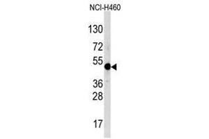 Image no. 1 for anti-Transcription Factor AP-2 alpha (Activating Enhancer Binding Protein 2 Alpha) (TFAP2A) (C-Term) antibody (ABIN357337) (TFAP2A 抗体  (C-Term))