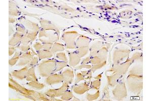Immunohistochemistry (IHC) image for anti-Collagen Triple Helix Repeat Containing 1 (CTHRC1) (AA 31-130) antibody (ABIN759281)