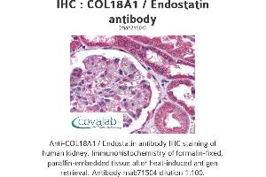 Image no. 1 for anti-Collagen, Type XVIII, alpha 1 (COL18A1) (full length) antibody (ABIN1724517) (COL18A1 抗体  (full length))