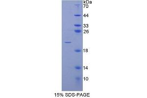 SDS-PAGE analysis of Human POFUT1 Protein. (POFUT1 蛋白)