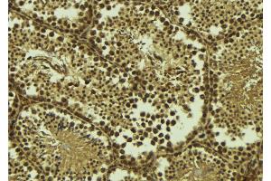 ABIN6273534 at 1/100 staining Mouse testis tissue by IHC-P. (TAF7L 抗体  (C-Term))