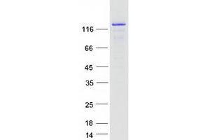 Western Blotting (WB) image for Cell Cycle and Apoptosis Regulator 2 (CCAR2) (Transcript Variant 1) protein (Myc-DYKDDDDK Tag) (ABIN2724224)