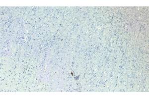 Immunohistochemistry (IHC) image for anti-Roundabout, Axon Guidance Receptor, Homolog 1 (ROBO1) (Internal Region) antibody (ABIN185537)
