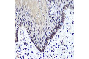 Immunohistochemistry of paraffin-embedded Human esophageal using TKT antibody (ABIN6128870, ABIN6149201, ABIN6149203 and ABIN6221921) at dilution of 1:100 (40x lens). (TKT 抗体  (AA 1-280))
