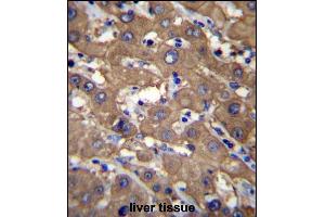 UGDH Antibody (C-term) (ABIN656544 and ABIN2845808) immunohistochemistry analysis in formalin fixed and paraffin embedded human liver tissue followed by peroxidase conjugation of the secondary antibody and DAB staining. (UGDH 抗体  (C-Term))