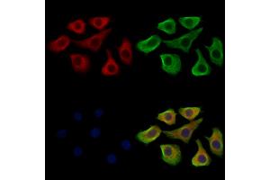ABIN7094714 and ABIN7098765 staining Hela cells by IF/ICC. (RAPGEF4 抗体  (C-Term))