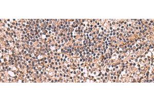 Immunohistochemistry of paraffin-embedded Human tonsil tissue using NOTCH4 Polyclonal Antibody at dilution of 1:30(x200) (NOTCH4 抗体)