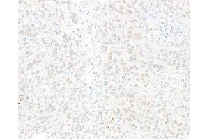 Immunohistochemistry (IHC) image for anti-Jun Dimerization Protein 2 (JDP2) (AA 50-100) antibody (ABIN7795636) (Recombinant JDP2 抗体  (AA 50-100))