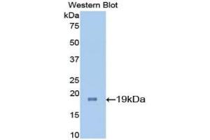 Western blot analysis of the recombinant protein. (IL-7 抗体  (AA 26-154))