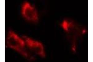 ABIN6275757 staining HuvEC cells by IF/ICC. (DGKB 抗体  (C-Term))