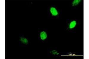Immunofluorescence of purified MaxPab antibody to MGMT on HeLa cell. (MGMT 抗体  (AA 1-207))