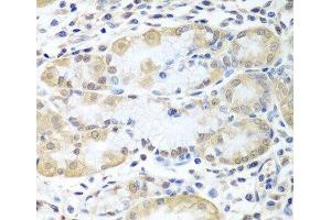 Immunohistochemistry of paraffin-embedded Human stomach using ASNA1 Polyclonal Antibody at dilution of 1:100 (40x lens). (ASNA1 抗体)