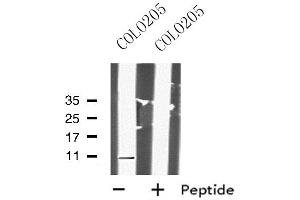 Western blot analysis of DAP using COLO205 whole cell lysates (DAP 抗体  (N-Term))