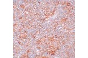 Immunohistochemistry of TMEM38B in mouse thymus tissue with this product at 5 μg/ml. (TMEM38B 抗体  (C-Term))