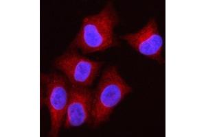 IF analysis of OLAH using anti-OLAH antibody (ABIN7599930). (OLAH 抗体  (AA 13-265))