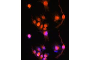 Immunofluorescence analysis of U-251 MG cells using PGP9. (UCHL1 抗体  (AA 59-223))