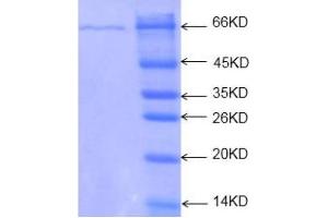12% SDS-PAGE of recombinant TPM2 protein. (TPM2 蛋白)