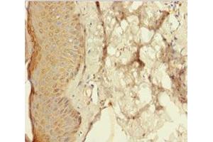 Immunohistochemistry of paraffin-embedded human skin tissue using ABIN7167717 at dilution of 1:100 (Resistin 抗体  (AA 19-108))