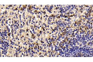 Detection of LTbR in Human Spleen Tissue using Monoclonal Antibody to Lymphotoxin Beta Receptor (LTbR) (LTBR 抗体  (AA 66-215))