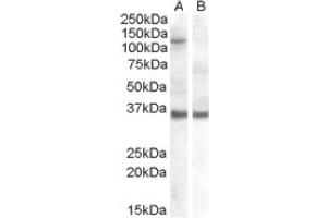 Image no. 1 for anti-Eukaryotic Translation Initiation Factor 2C, 1 (EIF2C1) (Internal Region) antibody (ABIN374655) (AGO1 抗体  (Internal Region))