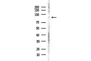 anti-Minichromosome Maintenance Deficient 8 (MCM8) (C-Term) antibody