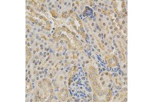 Immunohistochemistry of paraffin-embedded mouse kidney using ADD1 antibody at dilution of 1:200 (x400 lens) (alpha Adducin 抗体  (AA 60-300))