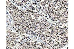 IHC analysis of AREB6/ZEB1 using anti-AREB6/ZEB1 antibody (ABIN7602990).