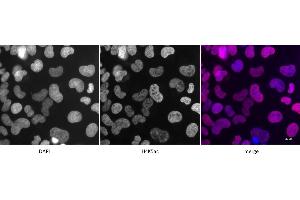 Detection of H4K5ac by immunofluorescence. (Histone H4 抗体  (acLys5))