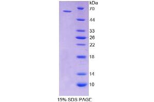 SDS-PAGE analysis of Rat CD19 Protein. (CD19 蛋白)