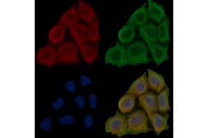 ABIN6257397 and ABIN6276107 staining Hela cells(30 min of UV treatment) by IF/ICC.