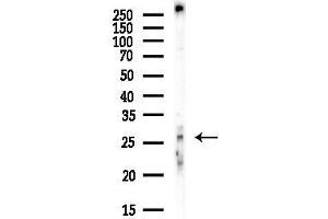 Western blot analysis of lysates from 3-L1 P6(heat-shock, 45 min treatment), using TFPI2 Antibody at 1/1000 dilution.