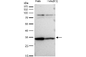 Western Blotting (WB) image for anti-Actin Related Protein 2/3 Complex, Subunit 2, 34kDa (ARPC2) antibody (ABIN7606824)