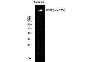 Western Blotting (WB) image for anti-Inositol 1,4,5-Trisphosphate Receptor, Type 1 (ITPR1) (pSer1764) antibody (ABIN3173506) (ITPR1 抗体  (pSer1764))