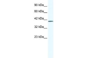 WB Suggested Anti-ZNF322A Antibody Titration:  0. (ZNF322A 抗体  (N-Term))