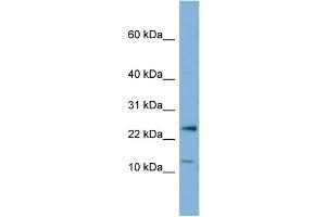 Western Blotting (WB) image for anti-Protein Phosphatase 1, Regulatory (Inhibitor) Subunit 11 (PPP1R11) (N-Term) antibody (ABIN2783353)