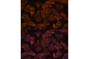Immunofluorescence analysis of C6 cells using Sec23B antibody (ABIN7270169) at dilution of 1:100. (Sec23 Homolog B 抗体  (AA 150-250))