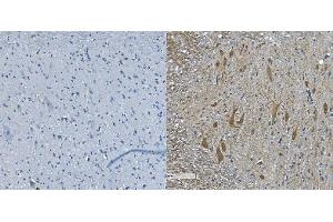 IHC analysis of Nefh using anti-Nefh antibody (ABIN7599700).