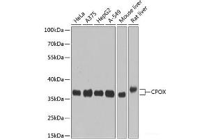 Western blot analysis of extracts of various cell lines using CPOX Polyclonal Antibody at dilution of 1:1000. (CPOX 抗体)