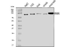 Western blot analysis of Golgin 97/GOLGA1 using anti-Golgin 97/GOLGA1 antibody (ABIN7599539).
