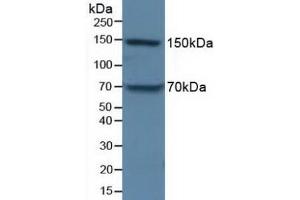 Detection of APOB in Porcine Liver Tissue using Polyclonal Antibody to Apolipoprotein B (APOB) (APOB 抗体  (AA 3365-3548))