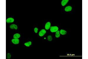Immunofluorescence (IF) image for anti-X-Ray Repair Complementing Defective Repair in Chinese Hamster Cells 5 (Double-Strand-Break Rejoining) (XRCC5) (AA 1-732) antibody (ABIN563391)