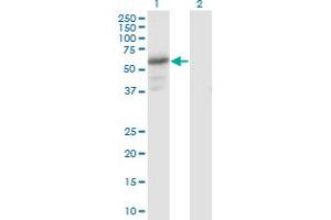 Western Blot analysis of PDZD3 expression in transfected 293T cell line by PDZD3 monoclonal antibody (M04), clone 1F2. (PDZD3 抗体  (AA 1-491))